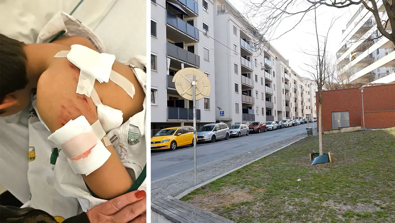 Ребёнок в больнице, хозяин под следствием: очередное нападение собаки в Австрии